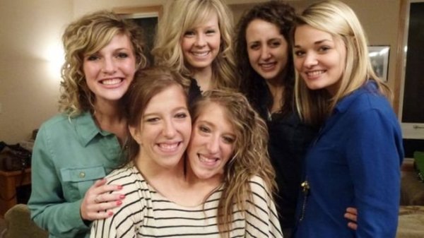 mas_abby-and-brittany-joined-for-life